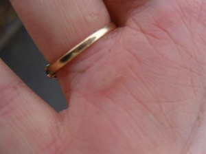 Second blister